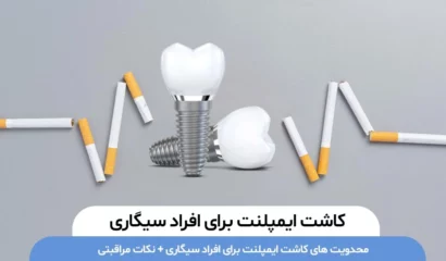 کاشت ایمپلنت برای افراد سیگاری