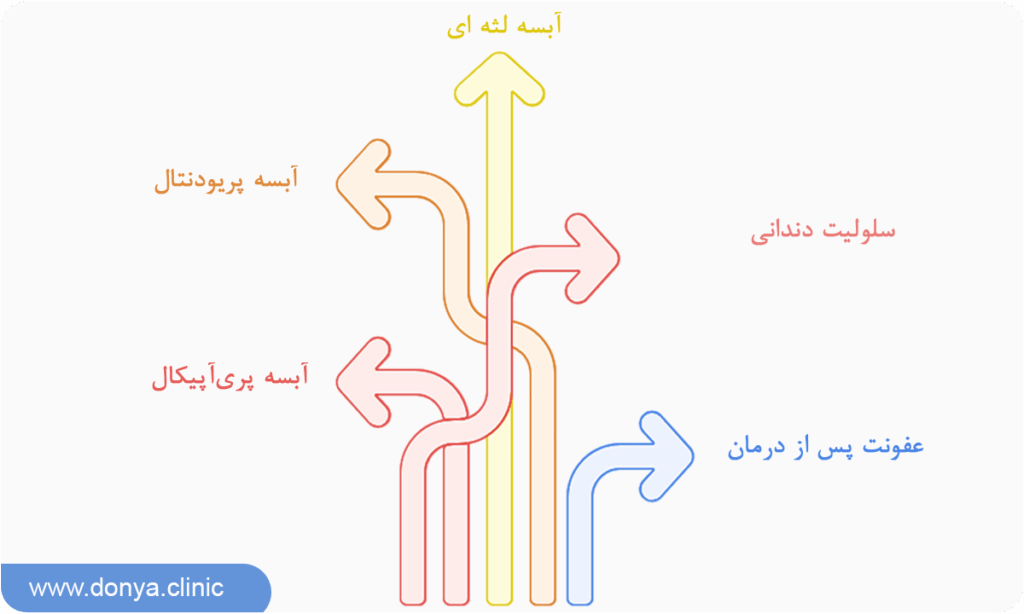 انواع عفونت دندان