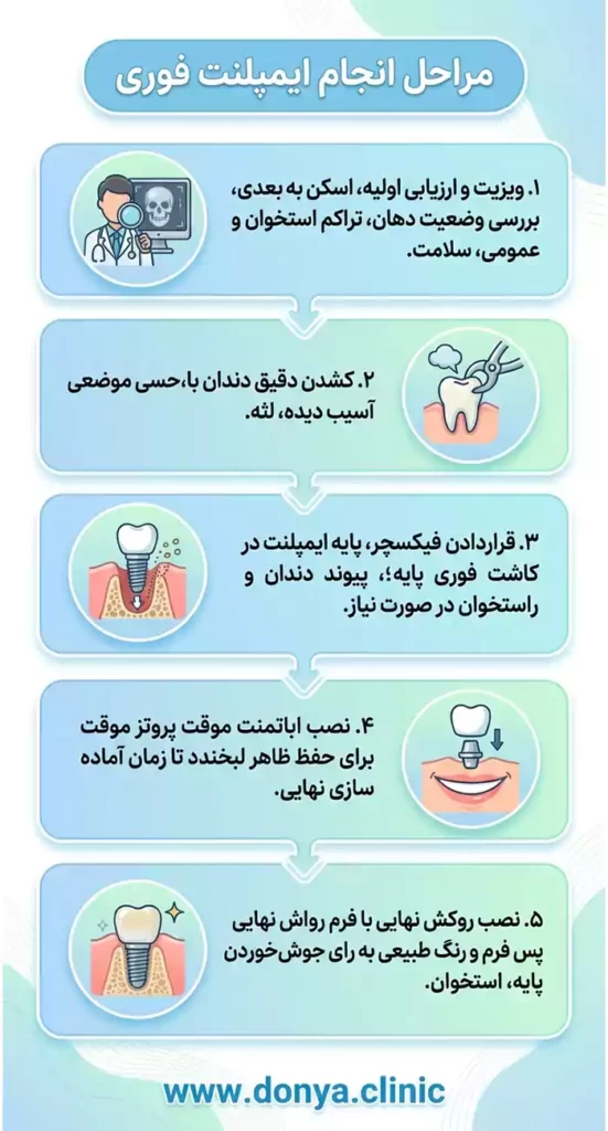 مراحل انجام ایمپلنت فوری