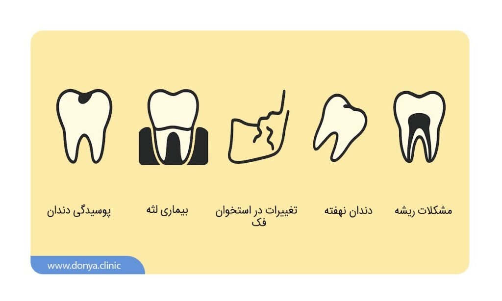 عکس دندان چه مشکلاتی را نشان می دهد؟