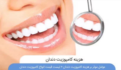 هزینه کامپوزیت دندان چقدر است ؟