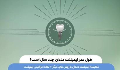 طول عمر ایمپلنت دندان چند سال است ؟