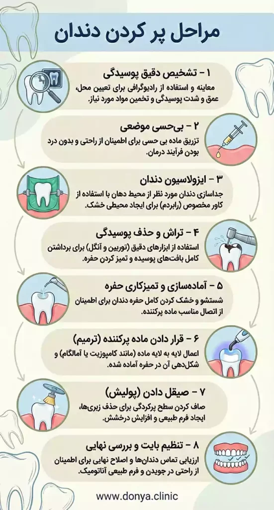 مراحل پر کردن دندان