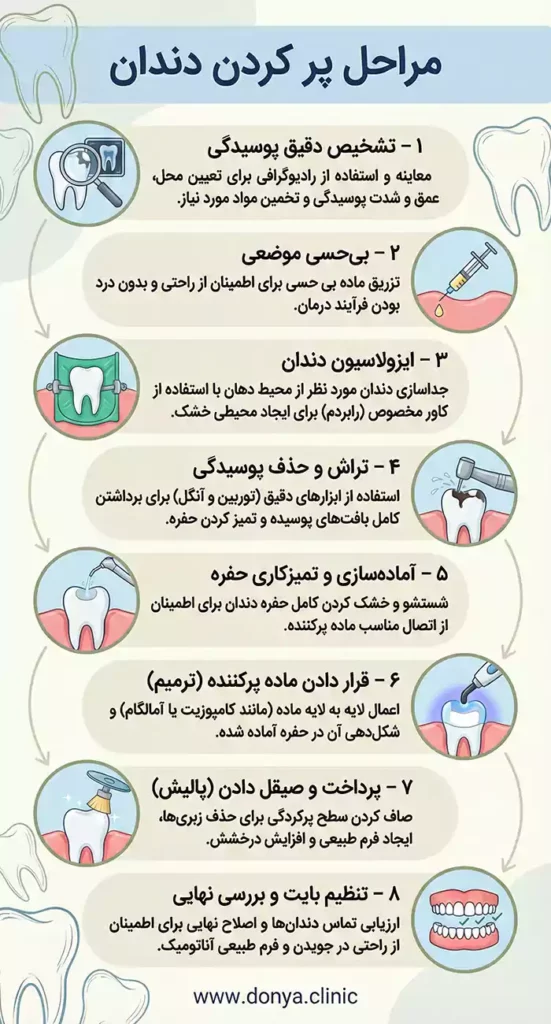 مراحل پر کردن دندان