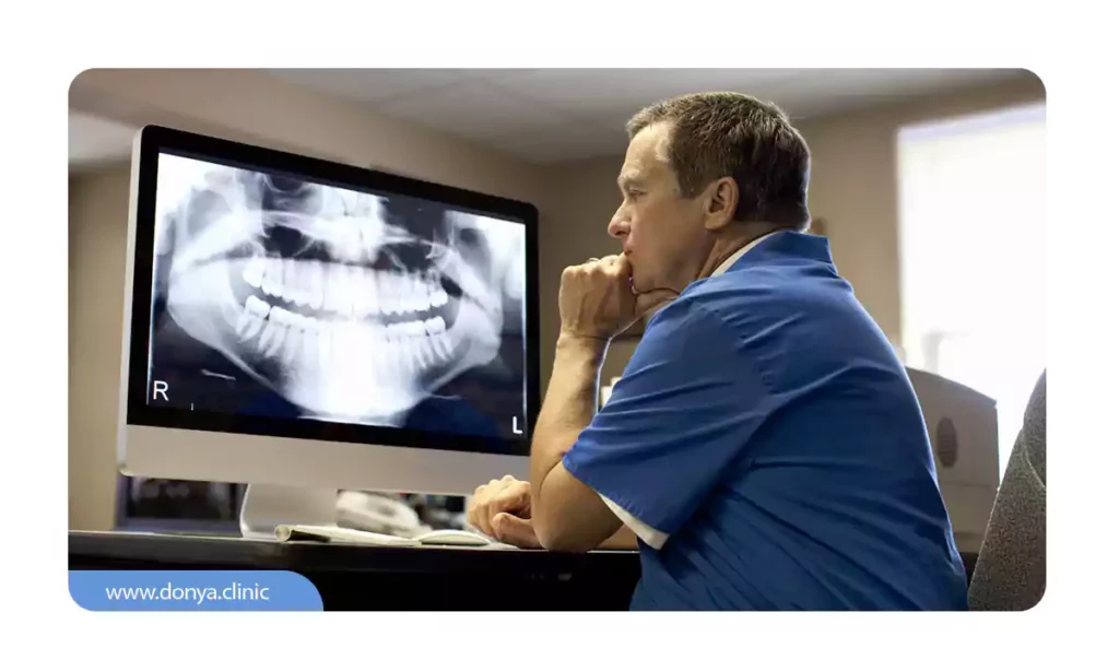 مشاهده عکس او چی توسط دکتر دندانپزشک برای تشخیص عمق پوسیدگی دندانی