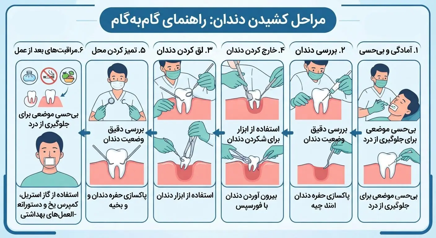 اینفوگرافی مراحل کشیدن دندان