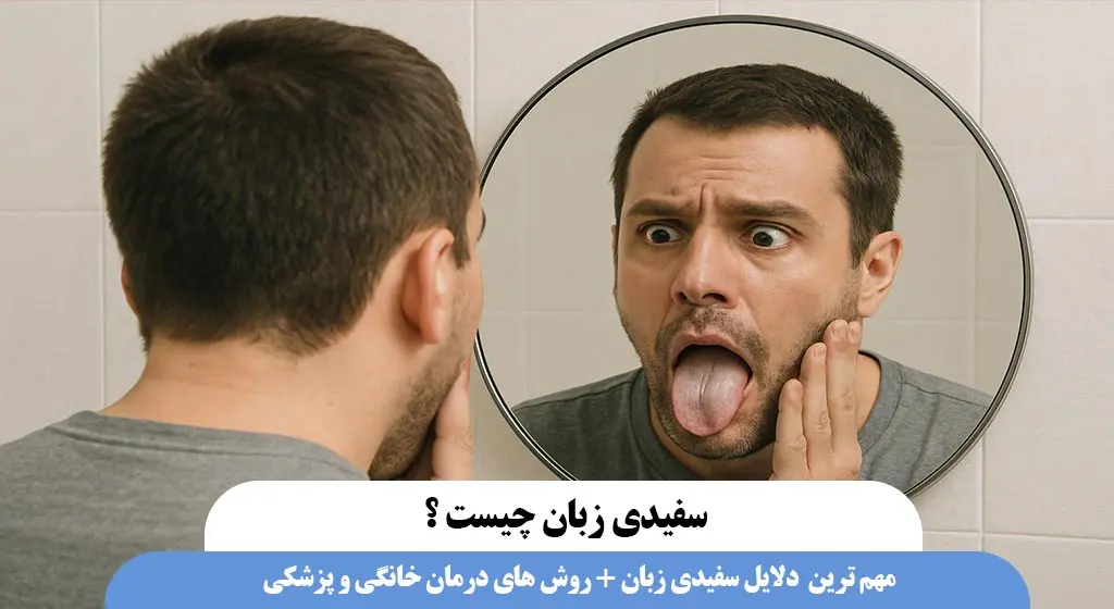 سفیدی زبان