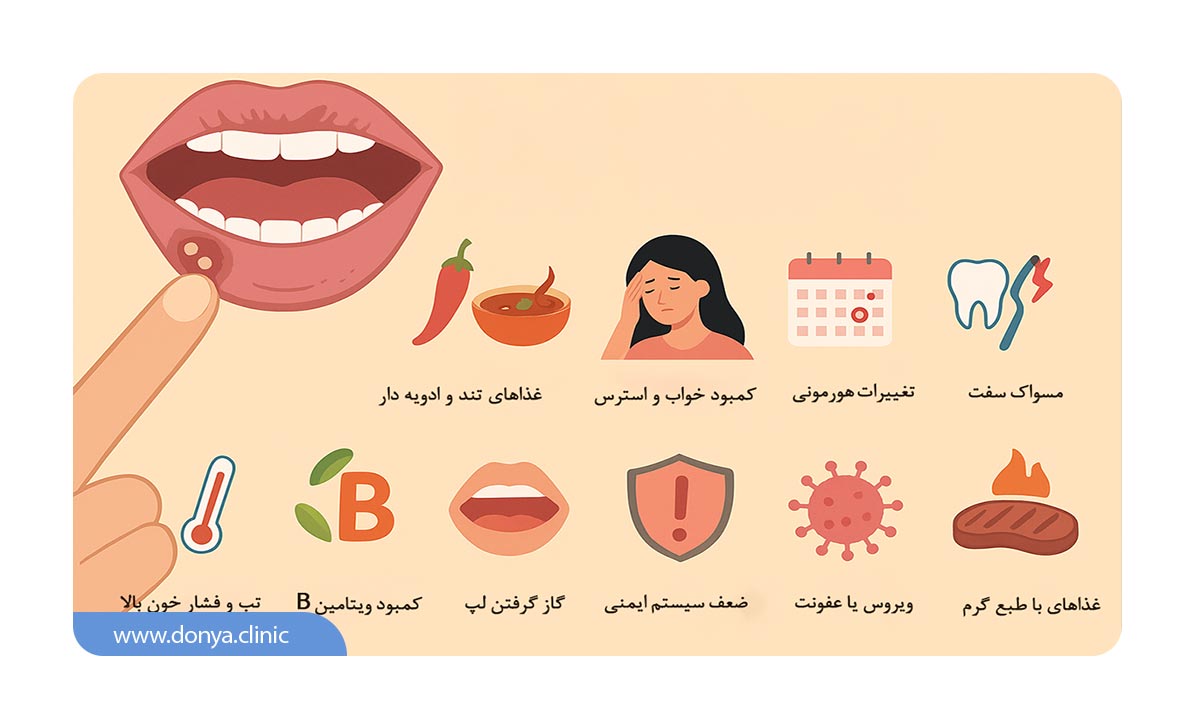 علت زخم دهان