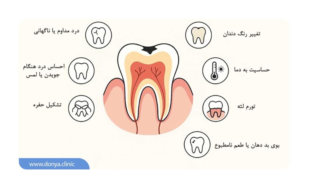 علائم دندان به عصب رسیده