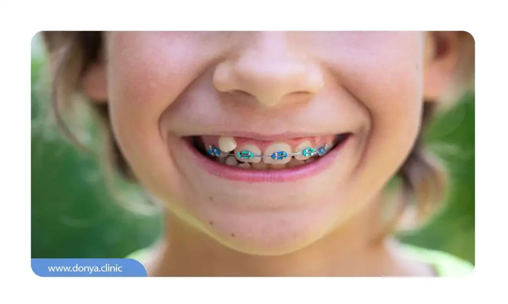 ارتودنسی کودکان