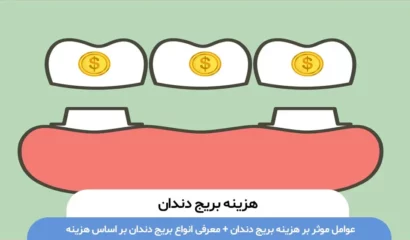 هزینه بریج دندان