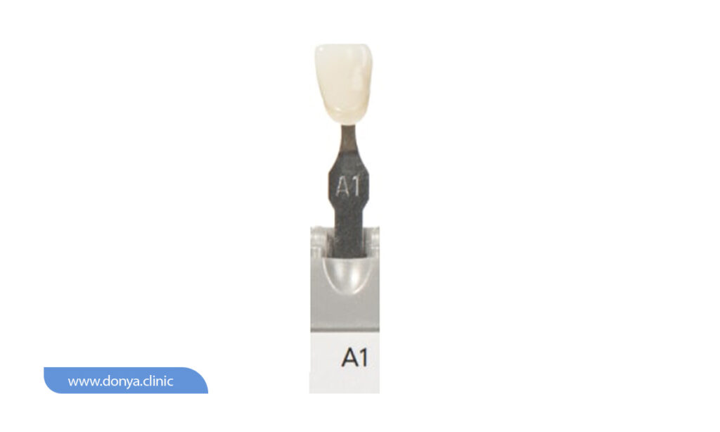 عکس رنگ لمینت دندان A1