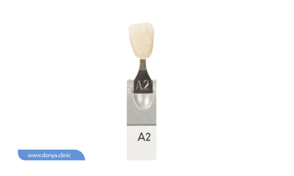 رنگ لمینت دندان A2