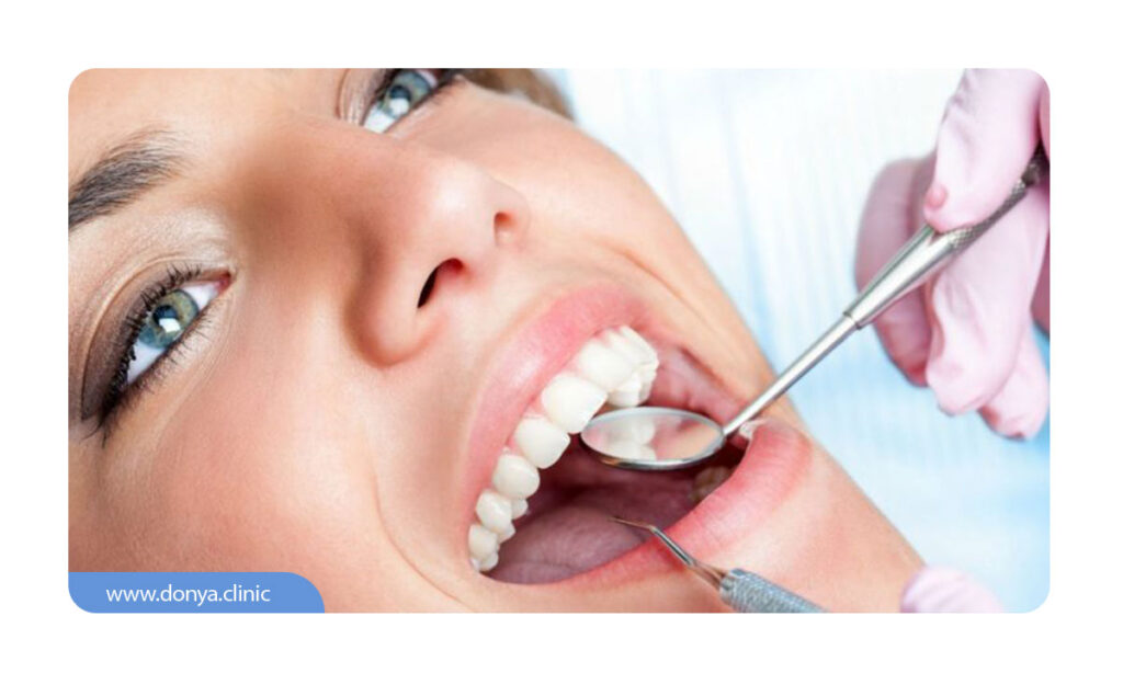 عکسی از مشاهده نتایج سفید کردن دندان ها