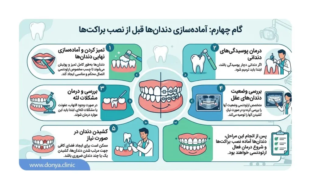 اینفوگرافیک مراحل آماده‌سازی دندان‌ها قبل از نصب براکت‌ها