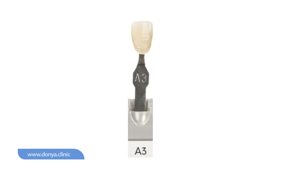 عکس رنگ لمینت دندان A3