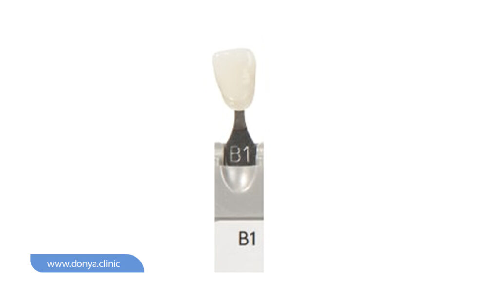 عکس رنگ لمینت دندان B1