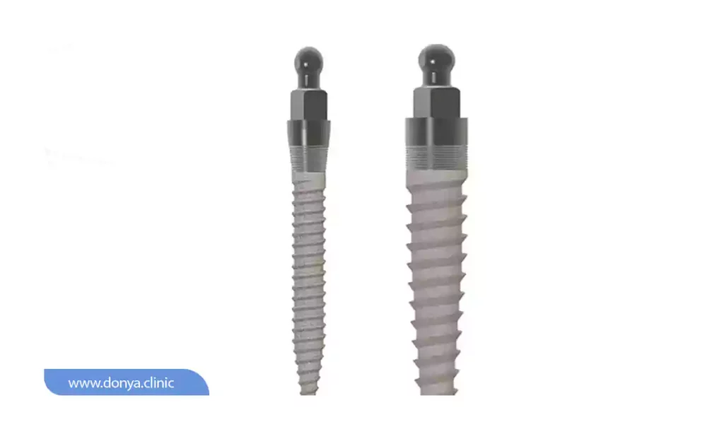 عکسی از ایمپلنت معمولی و مینی ایمپلنت