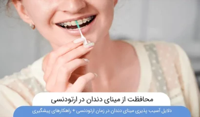 محافظت از مینای دندان در زمان ارتودنسی