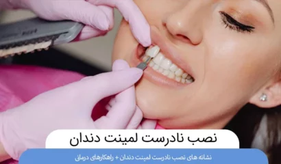 نصب نادرست لمینت دندان
