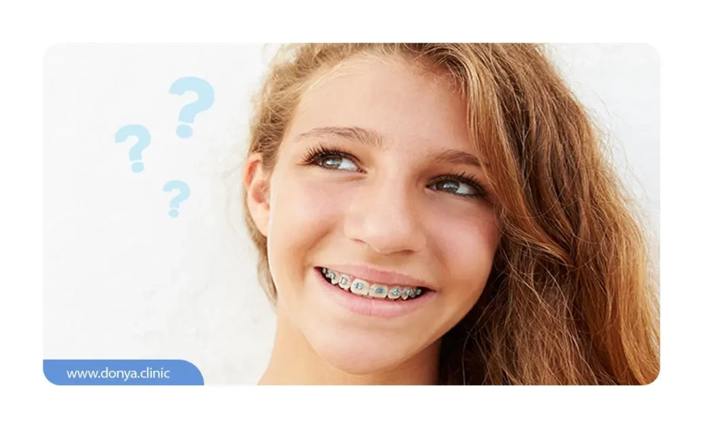 علت آسیب پذیر تر بودن مینای دندان در زمان ارتودنسی 