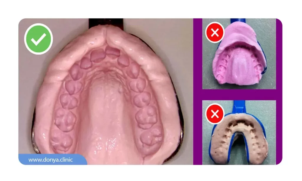 قالب گیری اشتباه