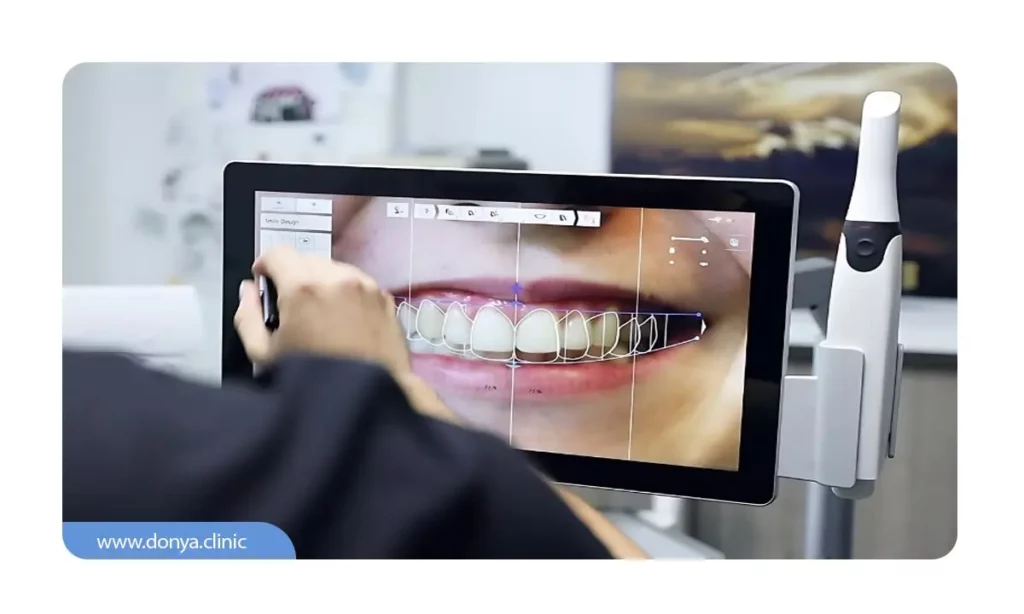 تفاوت لمینت دیجیتال به لحاظ رنگ و زیبایی