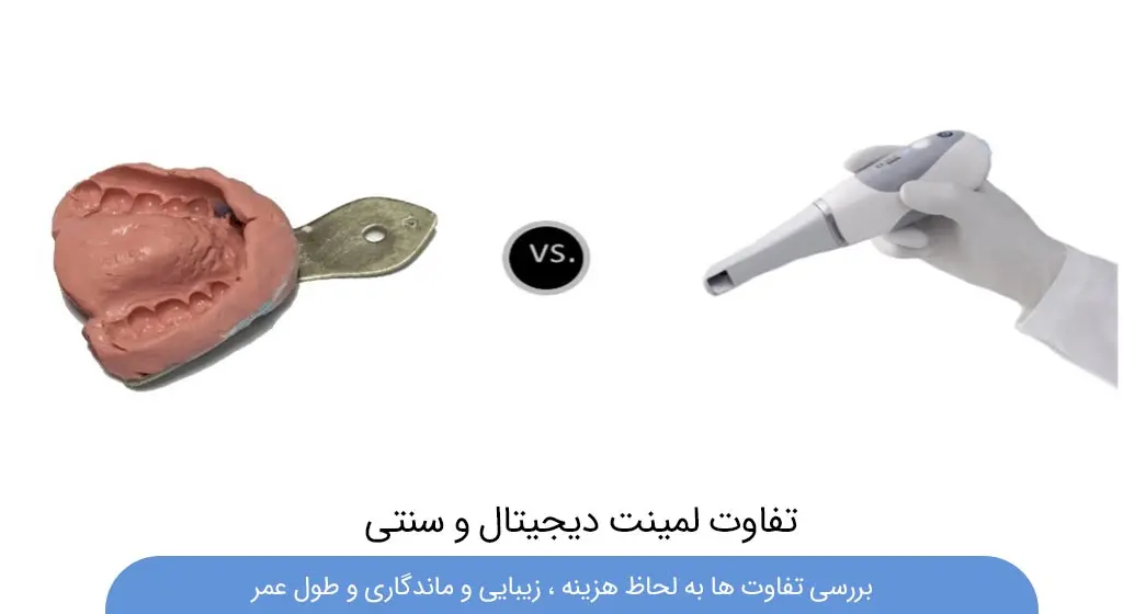 تفاوت لمینت دیجیتال و سنتی