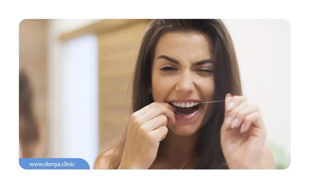 مراقبت های بعد از انجام لمینت دندان 