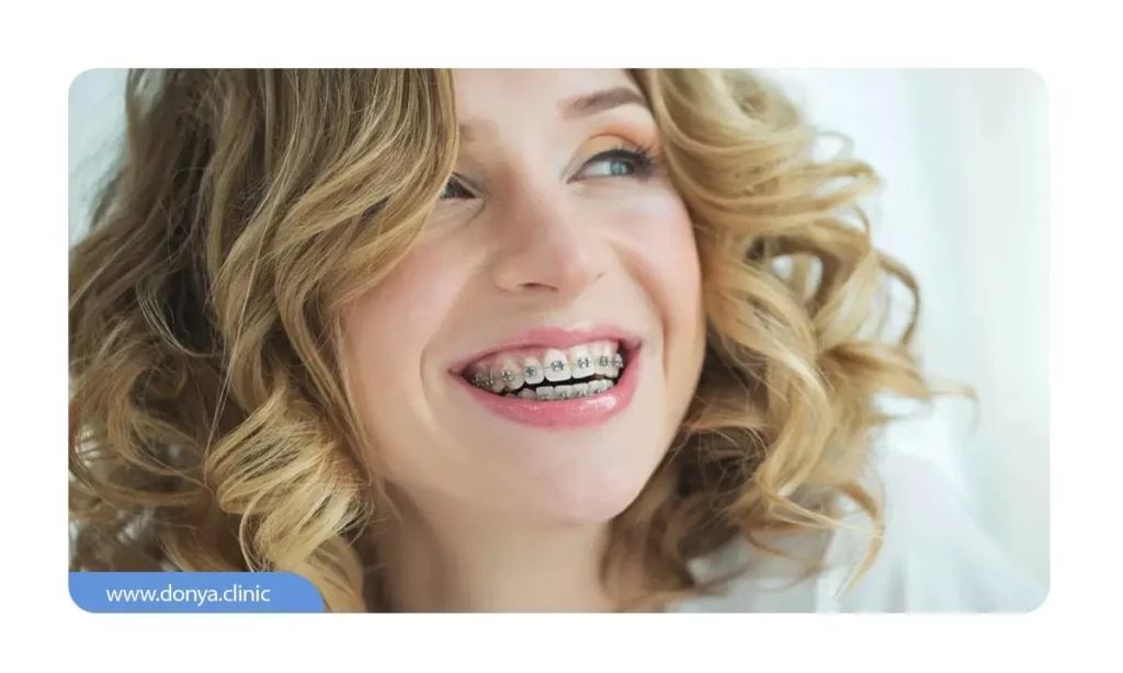 ارتودنسی بزرگسالان