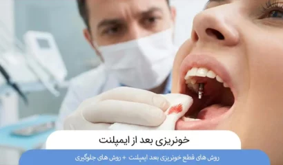 خونریزی بعد از ایمپلنت