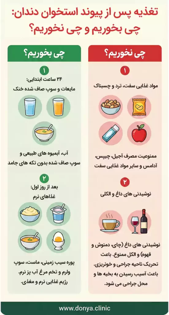 تغذیه پس از پیوند استخوان برای ایمپلنت