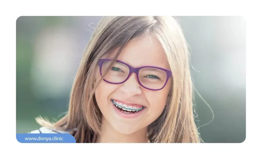 نقش سن در درمان انحراف چانه با ارتودنسی