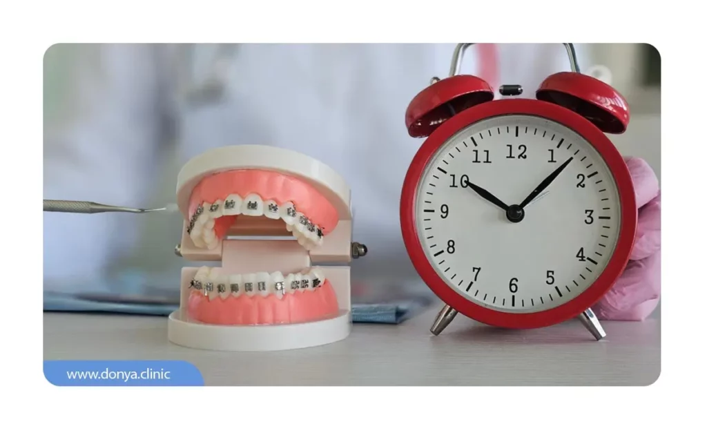مدت زمان درمان انحراف چانه با ارتودنسی