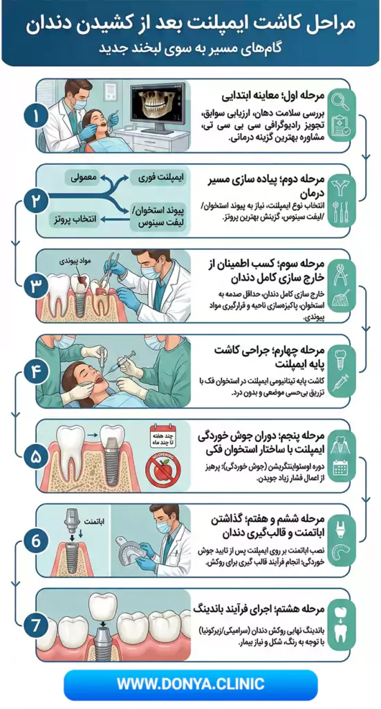 مراحل کاشت ایمپلنت بعد از کشیدن دندان