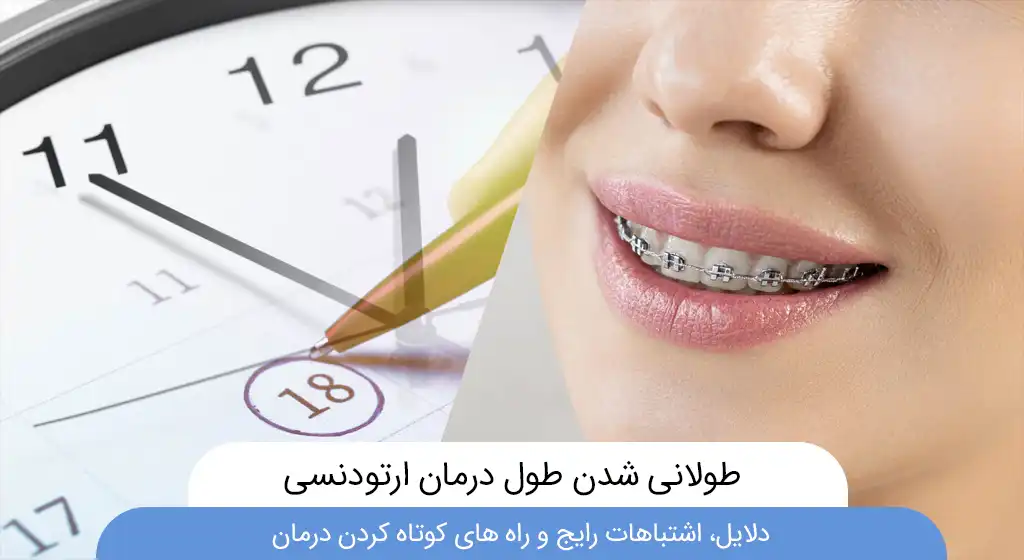 طولانی شدن درمان ارتودنسی
