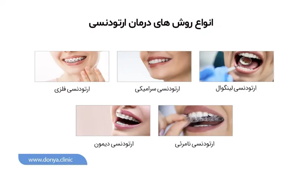 انواع روش های درمان ارتودنسی 