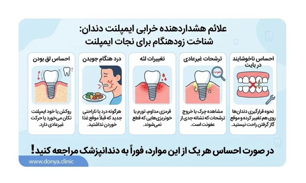 خرابی ایمپلنت دندان