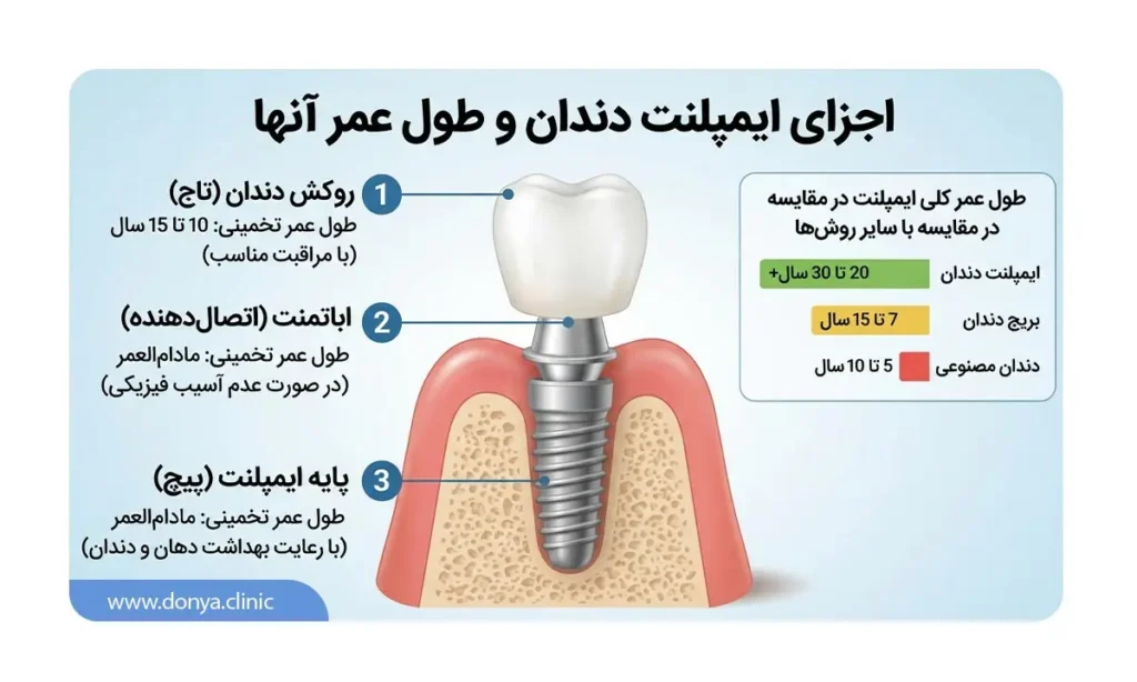 معرفی اجزای ایمپلنت