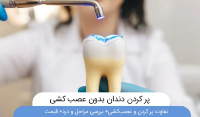 پر کردن دندان بدون عصب کشی