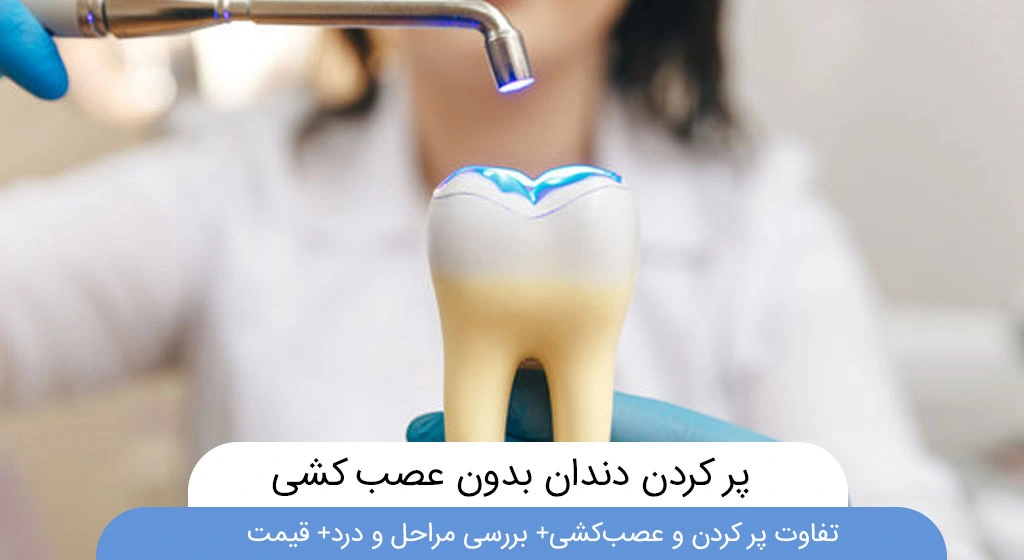 پر کردن دندان بدون عصب کشی