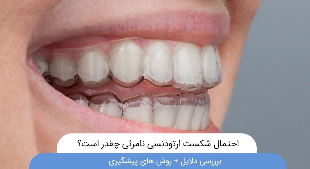 احتمال شکست ارتودنسی نامرئی چقدر است؟