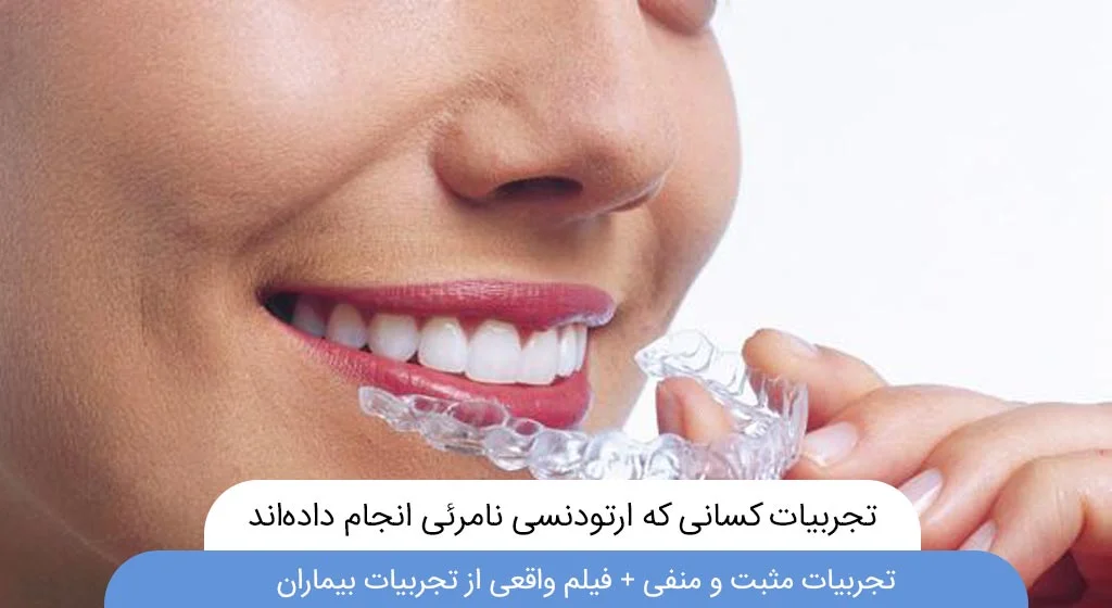 تجربیات کسانی که ارتودنسی نامرئی انجام داده اند