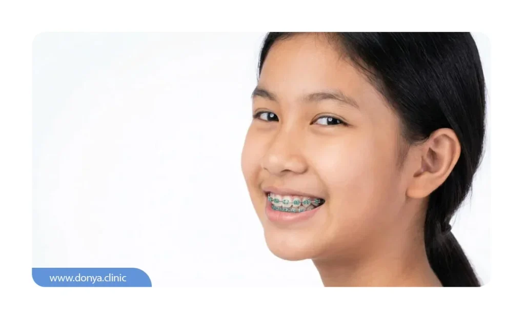 ارتودنسی رنگی کودکان