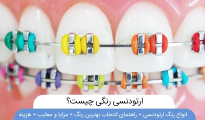 ارتودنسی رنگی چیست؟