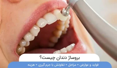 بروساژ دندان چیست؟